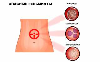 Гельминтоз – Симптомы и Лечение