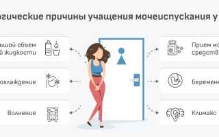Частое мочеиспускание у женщин ночью – признак серьезного заболевания