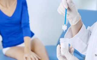 Что показывает и для чего сдают мазок на онкоцитологию?