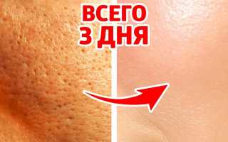 Как сузить поры в домашних условиях