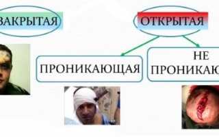 Оказание первой помощи при черепно-мозговой травме