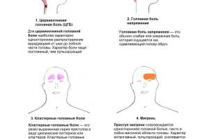 Головная боль: причины и способы борьбы