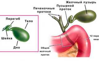 Что делать, если диагностировали перегиб желчного пузыря в шейке?