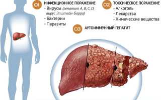 Причины боли в области печени