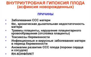 Причины и признаки гипоксии плода при беременности
