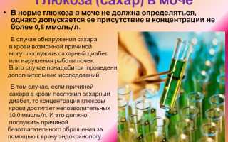 Глюкоза в моче. Причины появления