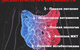 Дисбактериоз кишечника при беременности: причины, симптомы и лечение