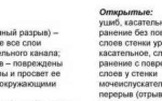 Травматический уретрит: особенности клиники и лечение