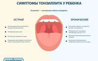 Как протекает острый тонзиллит у детей и как его вылечить