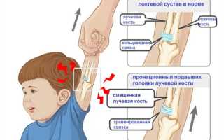 Вывих Руки У Ребенка