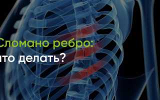 Как лечить сломанное ребро в домашних условиях