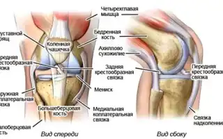 Как лечить растяжение связок коленного сустава?