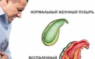 Симптомы болезней желчного пузыря