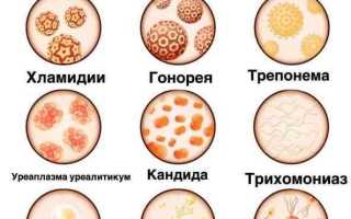 Самые распространенные венерические заболевания