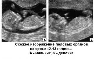 Когда можно узнать пол ребенка?