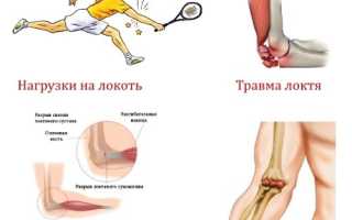 Боль в локте: причины и лечение