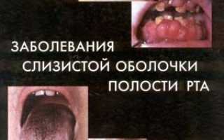 Ртутные Пломбы Вызывают Аутоиммунные Заболевания