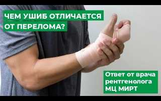 Как отличить ушиб от перелома?