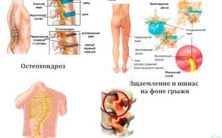 Болит в области поясницы: причины