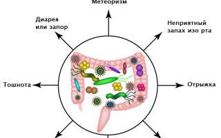 Дисбактериоз Причины, Симптомы, Диагностика, Лечение