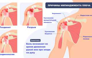 Мышечная боль в плече. Причины