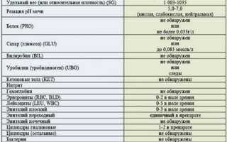 Слизь в моче при беременности – норма или нарушение?