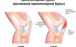 Ноющая боль в колене в покое. Причины появления