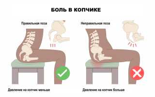 Что делать когда болит крестец